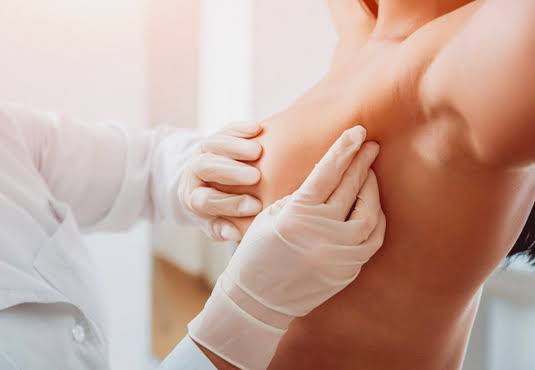 10 Practical Steps to Prevent Breast Cancer Every Woman Should Know