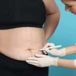 average cost of weight loss surgery options