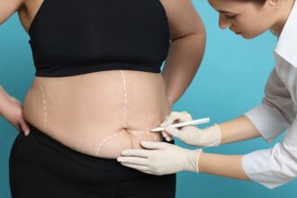 average cost of weight loss surgery options